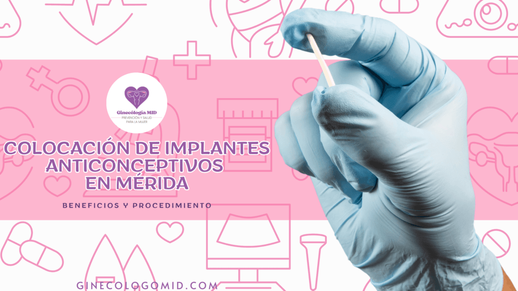 Colocación de implantes anticonceptivos ern Mérida